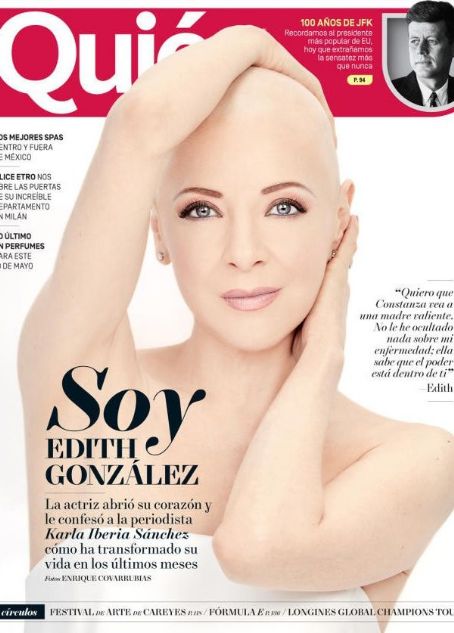 Edith Gonzalez With No Hair on Cover of Quien