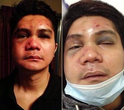 22-year-old student accuses Vhong Navarro of attempted rape