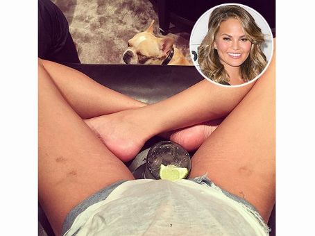 Chrissy Teigen Wants You to Say 'Hi' to Her Stretch Marks